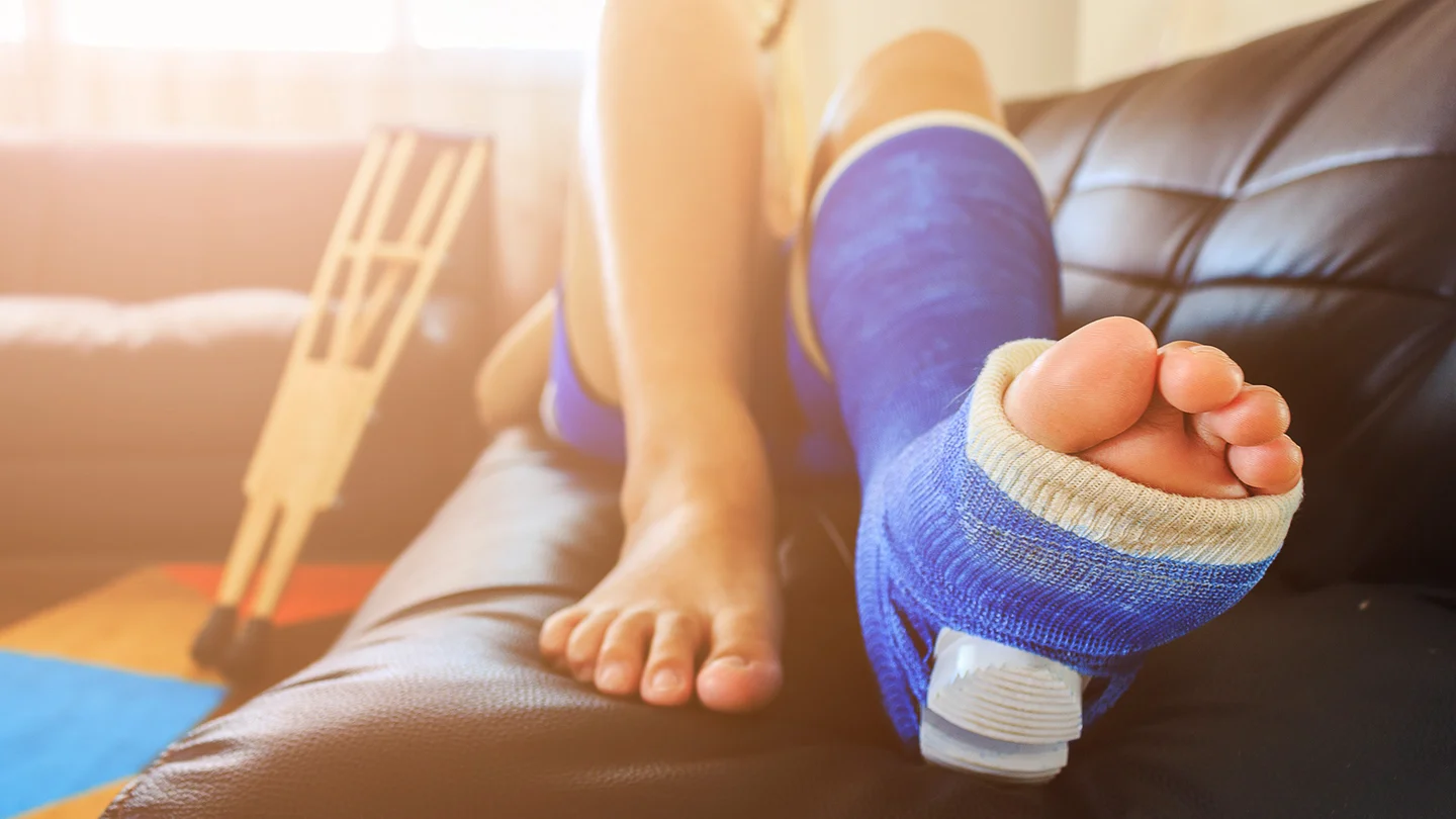 Person mit eingegipstem Fuß und Unterschenkel.