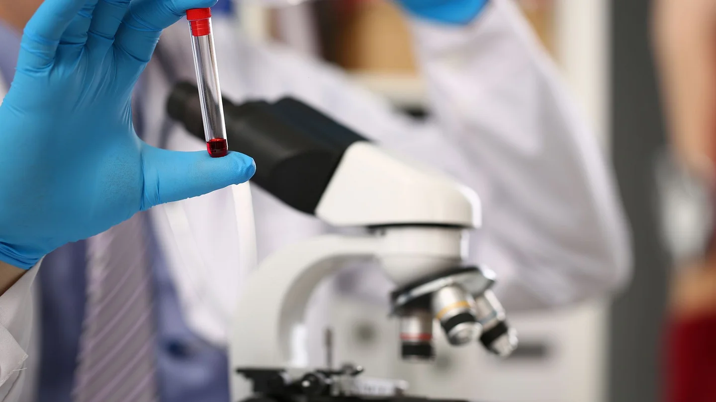 Eine Hand in Medizinhandschuhen h&auml;lt ein R&ouml;hrchen, in dem eine Blutprobe zur Untersuchung auf H&auml;mophilie ist. 