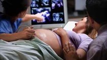 Schwangere mit Mann und &Auml;rztin bei einer Ultraschalluntersuchung.