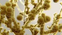 Pilz-Infektionen der Mundhöhle: Verantwortlich dafür sind Hefepilze – genauer: Candida-Hefen.