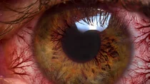 Nahaufnahme eines menschlichen Auges. Zu erkennen sind feine Blut&auml;derchen an der Linse.