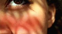 Rosazea: Die Wange einer Frau ist leicht geörtet. In ihrem Auge sind rote Äderchen zu sehen.