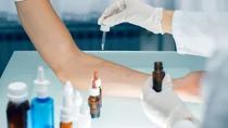 Ein Arzt träufelt mit einer Pipette Flüssigkeit auf den Unterarm eines Mannes. Auf dem Arm sind Linien und Testfelder aufgezeichnet.